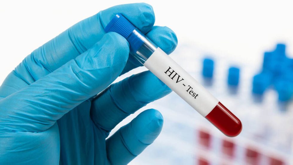 hiv test